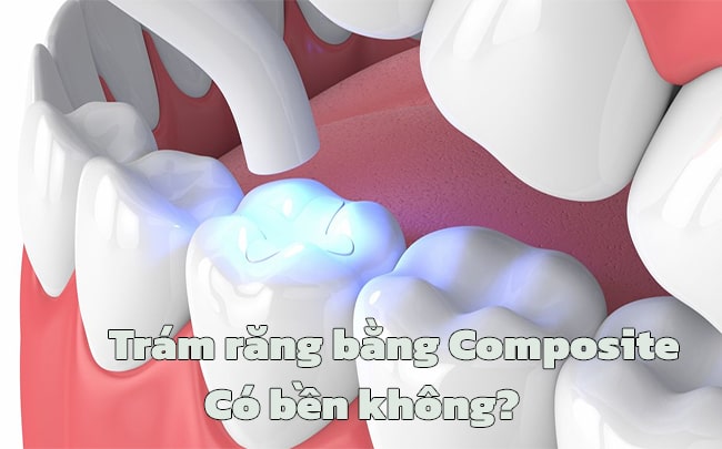 tram-rang-bang-composite-co-ben-khong