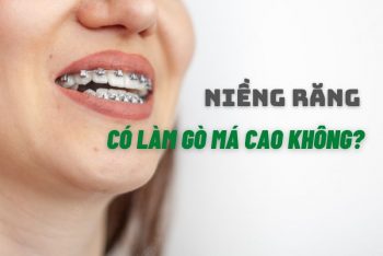 nieng-rang-co-lam-go-ma-cao-khong