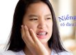 Niềng răng có đau không? Mọi điều bạn cần biết