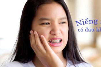 Niềng răng có đau không? Mọi điều bạn cần biết