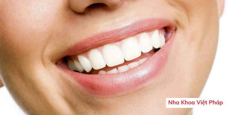  Phương pháp tẩy trắng răng phổ biến nhất