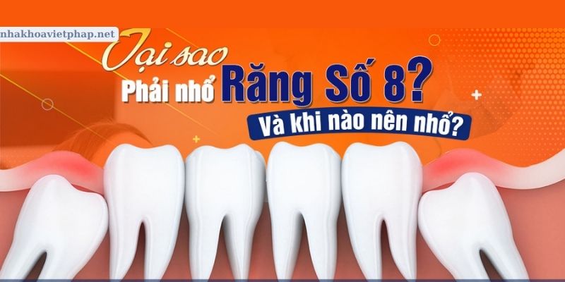 Khi nào nên nhổ răng số 8? Có nên nhổ răng số 8